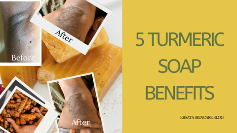The Top 5 Turmeric Soap Benefits for Glowing Skin